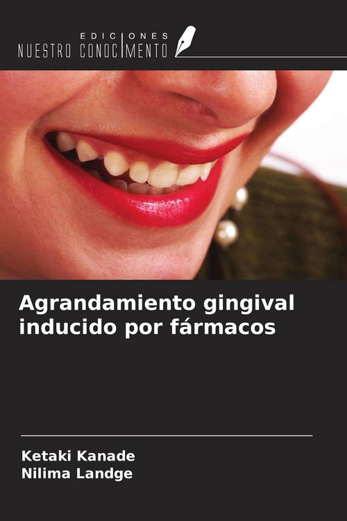 Produktbild: Agrandamiento gingival inducido por f&aacute;rmacos