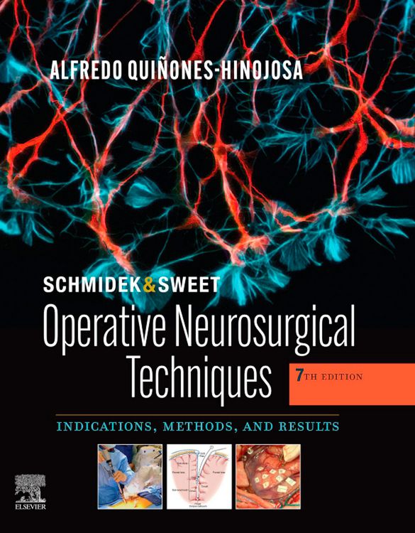 Produktbild: Schmidek and Sweet: Operative Neurosurgical Techniques E-Book