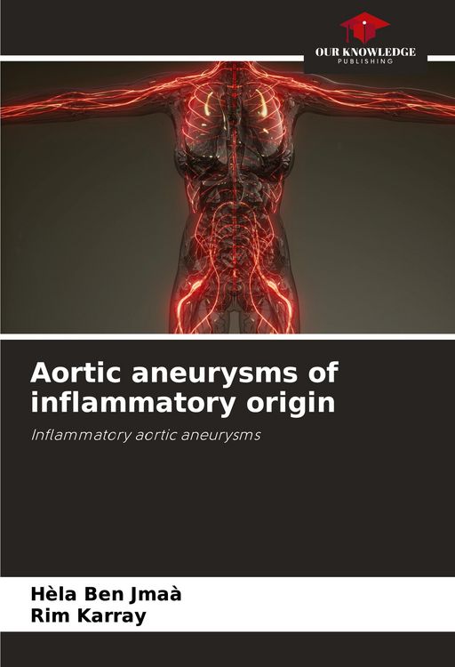 Produktbild: Aortic aneurysms of inflammatory origin