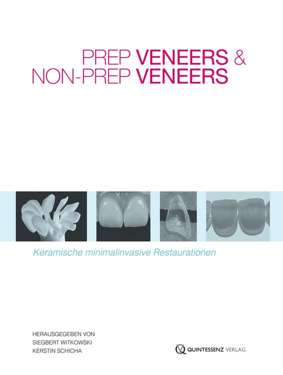 Produktbild: Prep Veneers und Non-Prep Veneers