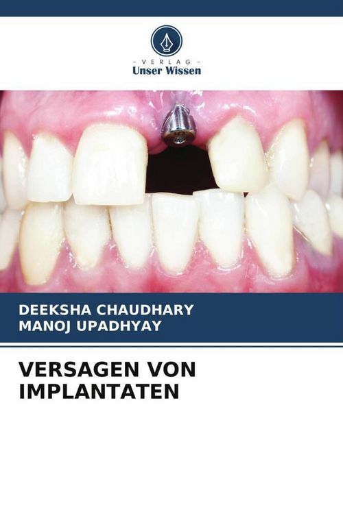 Produktbild: Versagen von Implantaten