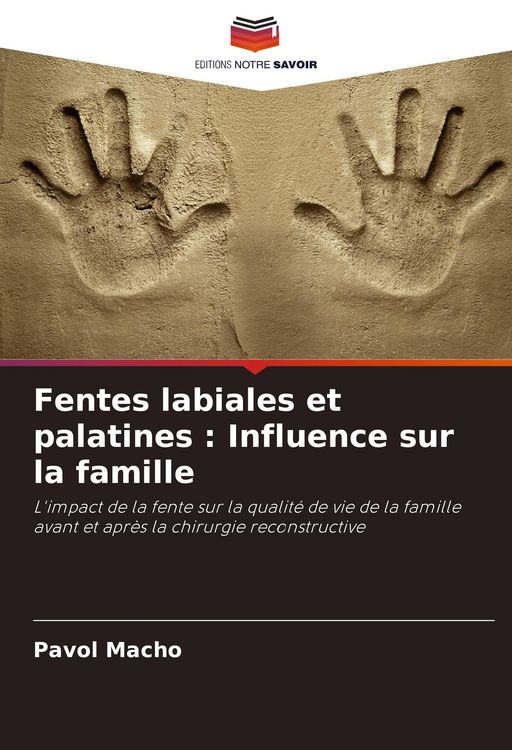 Produktbild: Fentes labiales et palatines : Influence sur la famille