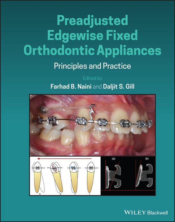 Produktbild: Preadjusted Edgewise Fixed Orthodontic Appliances