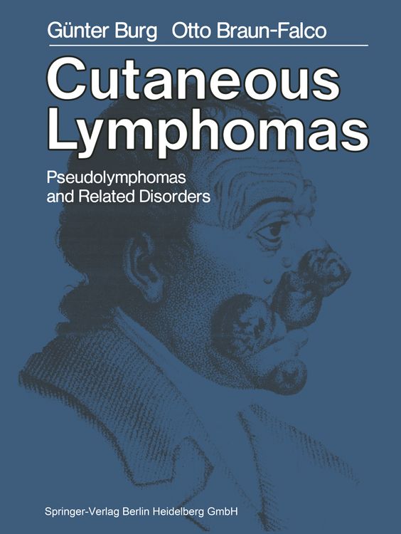 Produktbild: Cutaneous Lymphomas, Pseudolymphomas, and Related Disorders