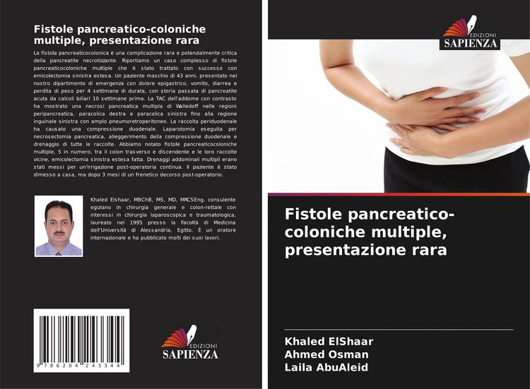 Produktbild: Fistole pancreatico-coloniche multiple, presentazione rara