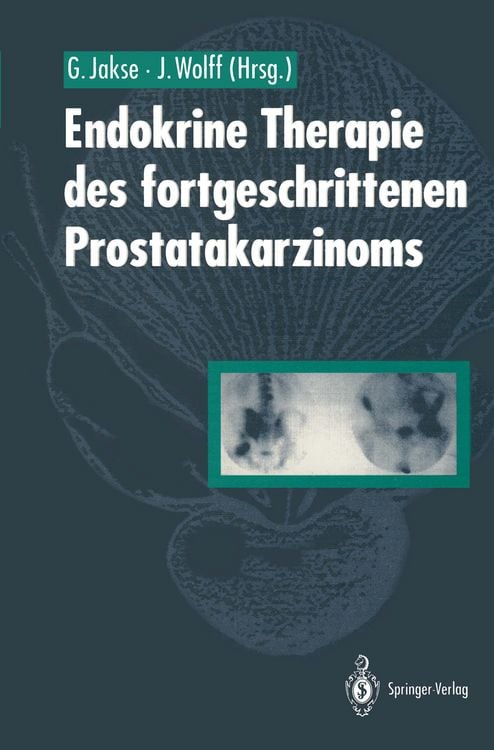 Produktbild: Endokrine Therapie des fortgeschrittenen Prostatakarzinoms