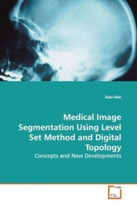 Produktbild: Han, X: Medical Image Segmentation Using Level Set Method an