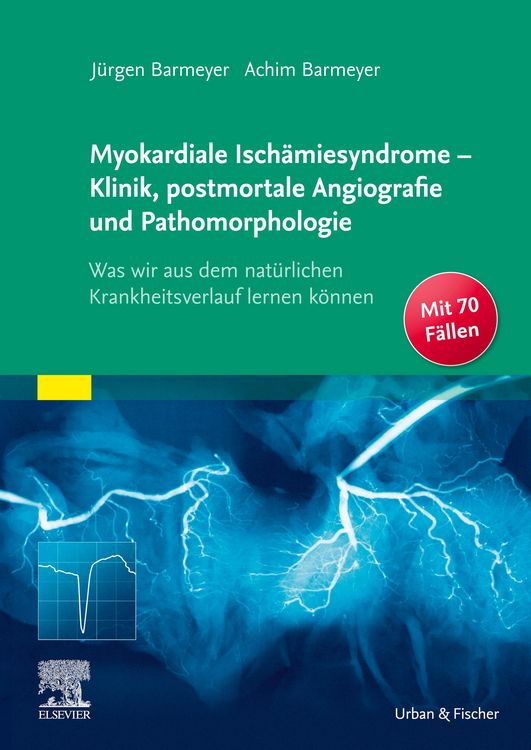 Produktbild: Die myokardialen Isch&auml;miesyndrome - Klinik und postmortale Pathomorphologie