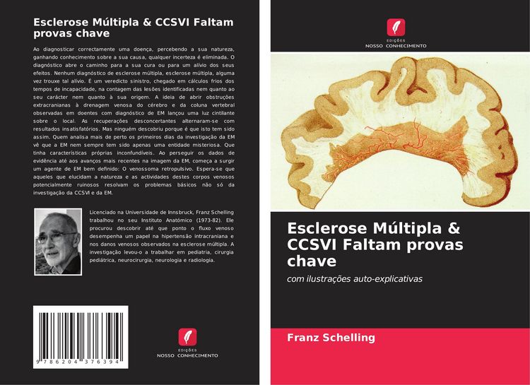 Produktbild: Esclerose M&uacute;ltipla & CCSVI Faltam provas chave