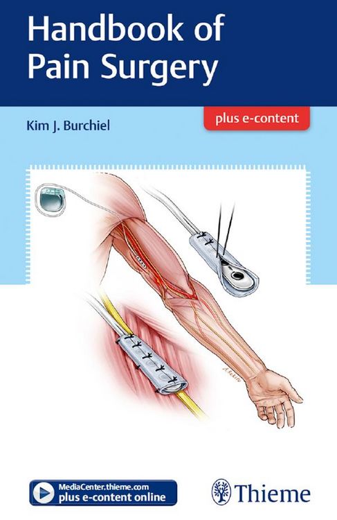 Produktbild: Handbook of Pain Surgery