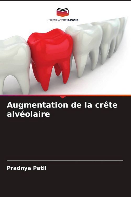Produktbild: Augmentation de la cr&ecirc;te alv&eacute;olaire