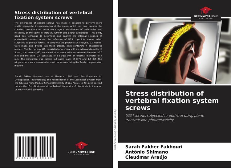 Produktbild: Stress distribution of vertebral fixation system screws