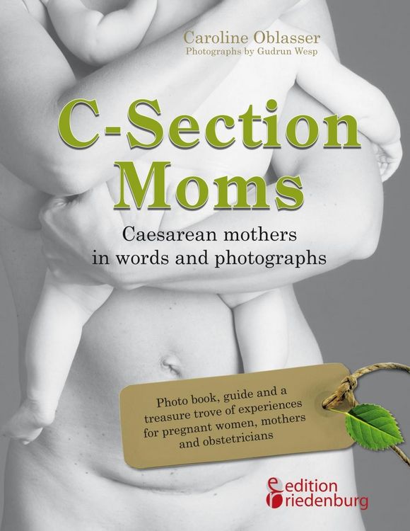 Produktbild: C-Section Moms - Caesarean mothers in words and photographs