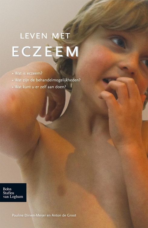 Produktbild: Leven met eczeem