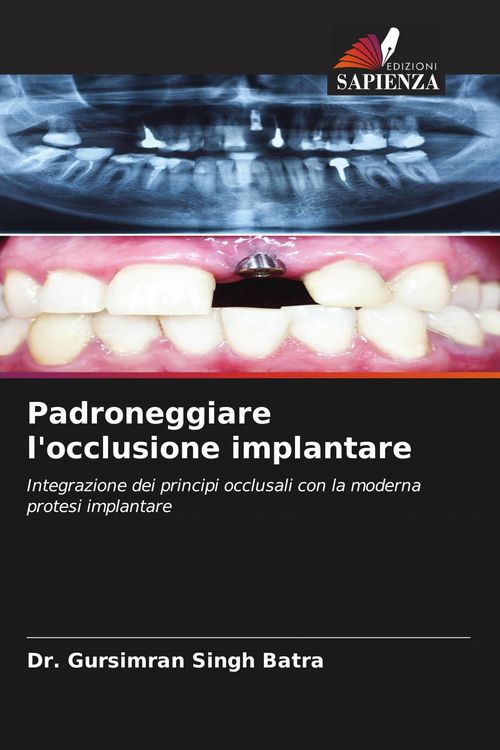 Produktbild: Padroneggiare l'occlusione implantare