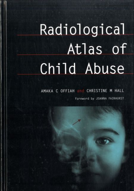 Produktbild: Offiah, A: Radiological Atlas of Child Abuse