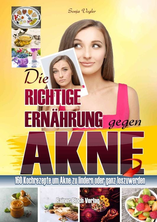 Produktbild: Die richtige Ern&auml;hrung gegen Akne