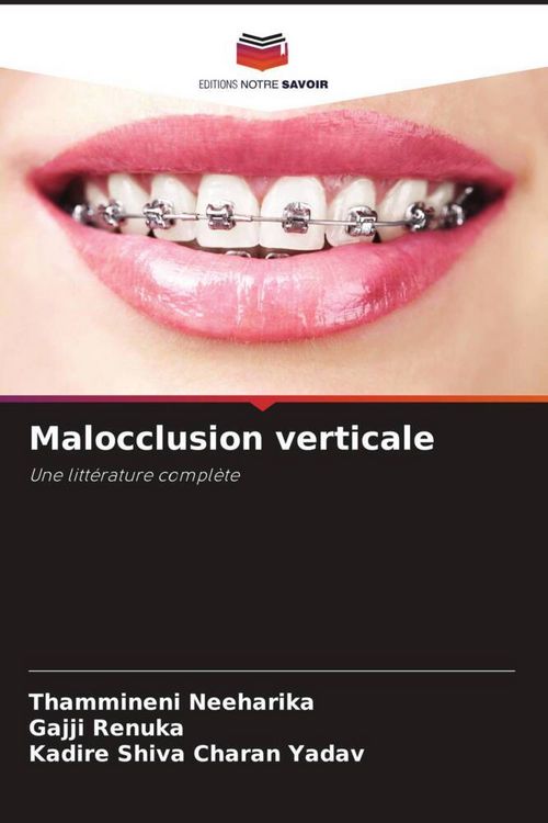 Produktbild: Malocclusion verticale