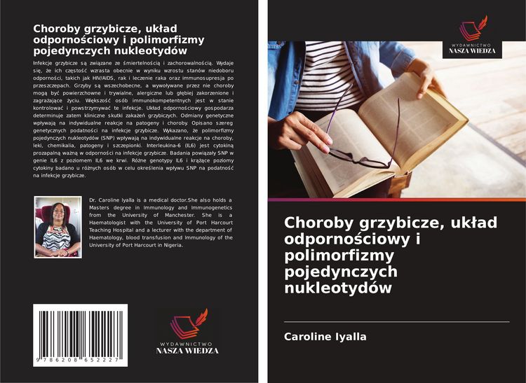 Produktbild: Choroby grzybicze, uk&iquest;ad odporno&iquest;ciowy i polimorfizmy pojedynczych nukleotyd&oacute;w