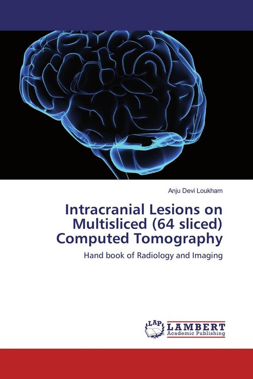 Produktbild: Intracranial Lesions on Multisliced (64 sliced) Computed Tomography