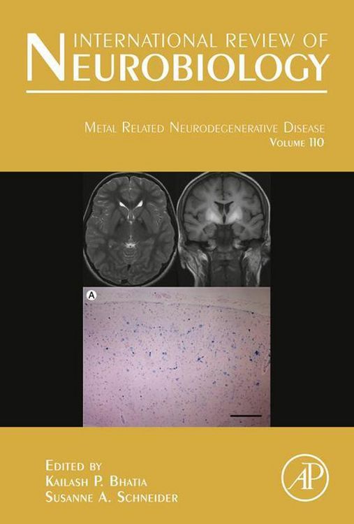 Produktbild: Metal Related Neurodegenerative Disease