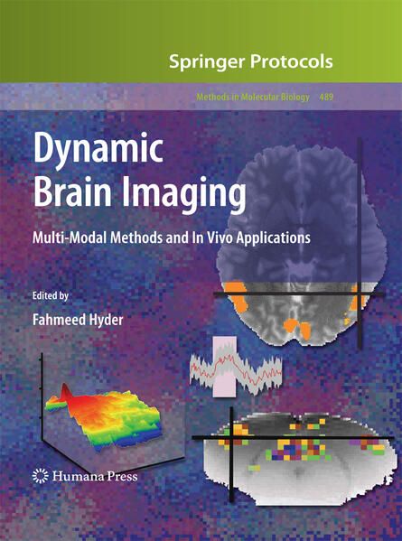 Produktbild: Dynamic Brain Imaging