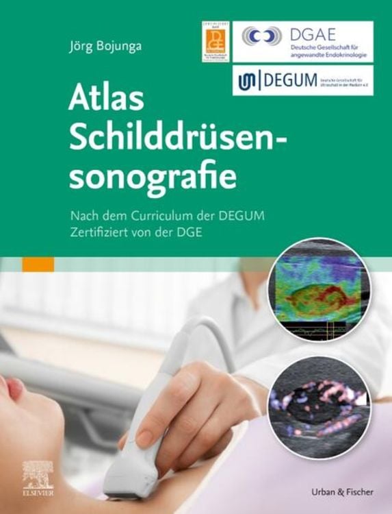 Produktbild: Atlas Schilddr&uuml;sensonografie