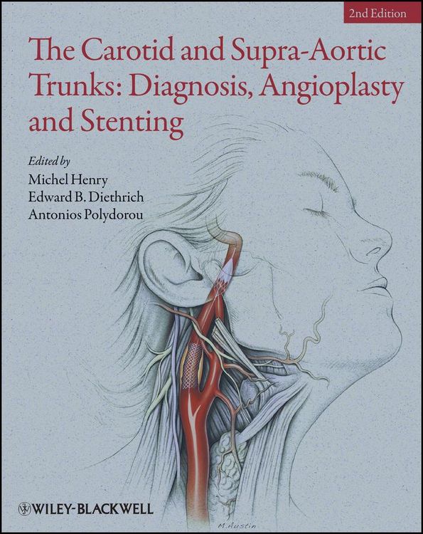 Produktbild: The Carotid and Supra-Aortic Trunks