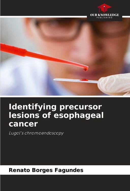 Produktbild: Identifying precursor lesions of esophageal cancer