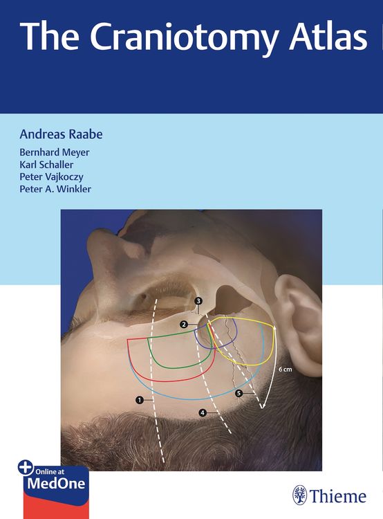 Produktbild: The Craniotomy Atlas