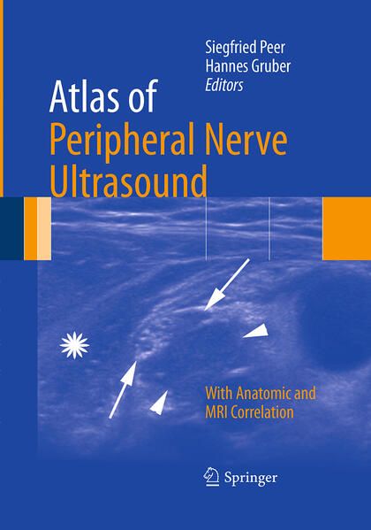 Produktbild: Atlas of Peripheral Nerve Ultrasound