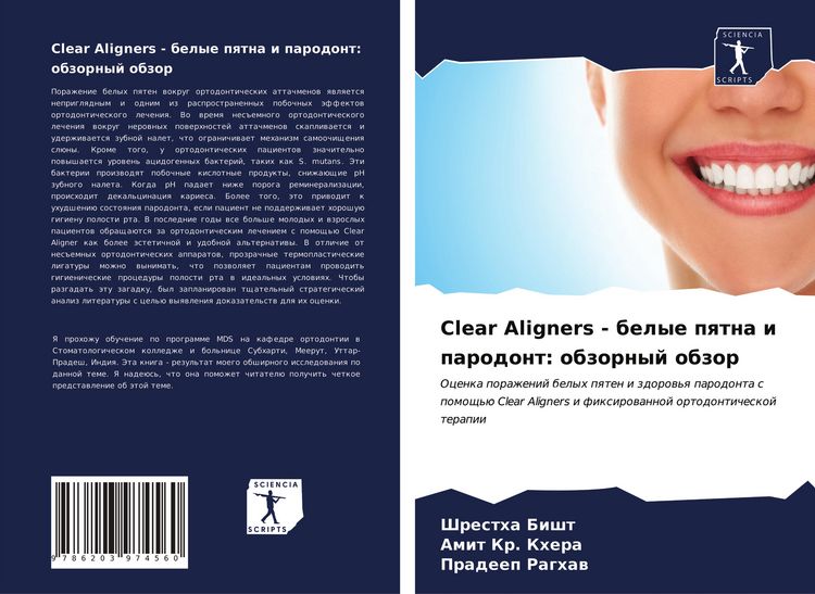 Produktbild: Clear Aligners - belye pqtna i parodont: obzornyj obzor