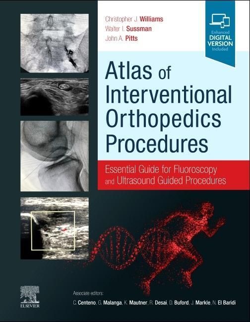 Produktbild: Atlas of Interventional Orthopedics Procedures