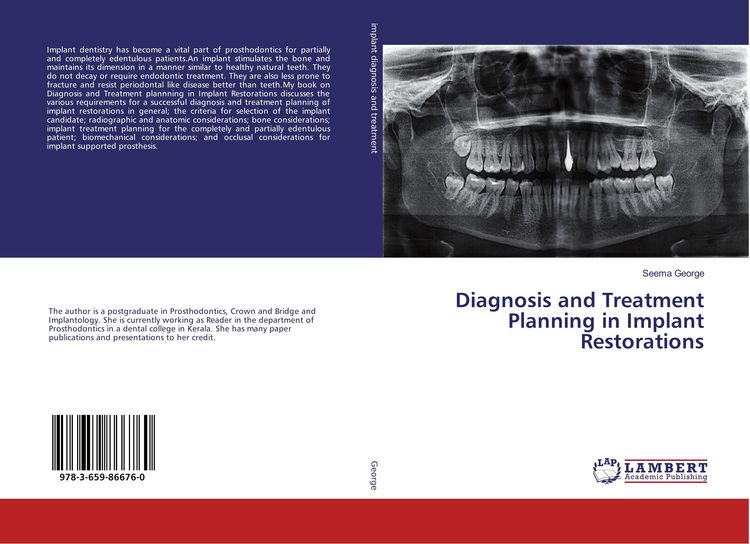 Produktbild: Diagnosis and Treatment Planning in Implant Restorations