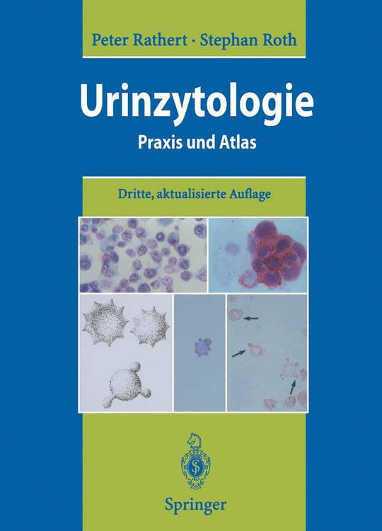 Produktbild: Urinzytologie