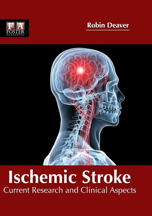 Produktbild: Ischemic Stroke
