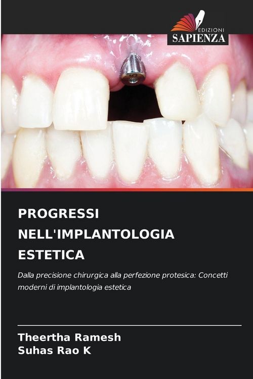 Produktbild: Progressi Nell'implantologia Estetica