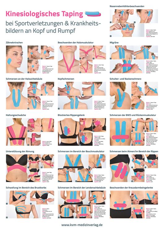 Produktbild: Poster Kinesiologisches Taping (3 Poster im Set)