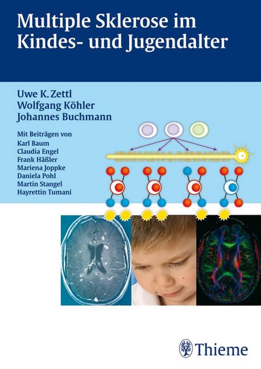 Produktbild: Multiple Sklerose im Kinder- und Jugendalter Mit Beitr&auml;gen von Karl Braun, Clau