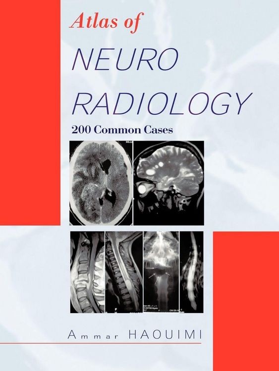 Produktbild: Atlas of Neuroradiology