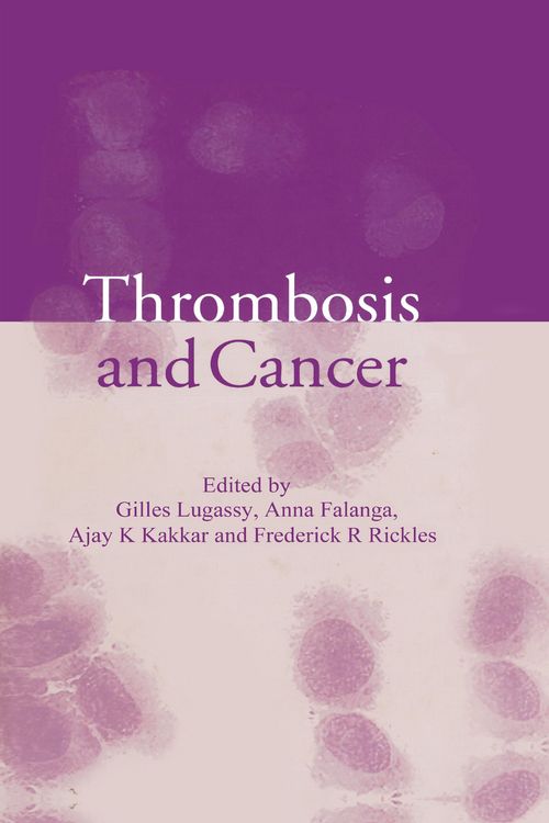 Produktbild: Thrombosis and Cancer