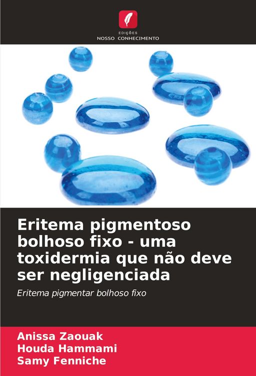 Produktbild: Eritema pigmentoso bolhoso fixo - uma toxidermia que n&atilde;o deve ser negligenciada