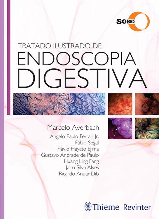 Produktbild: Tratado Ilustrado de Endoscopia Digestiva