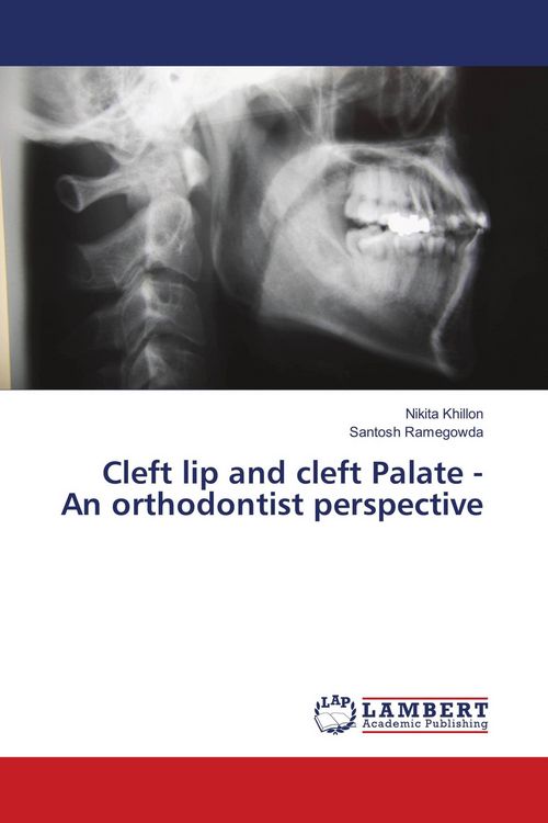Produktbild: Cleft lip and cleft Palate - An orthodontist perspective