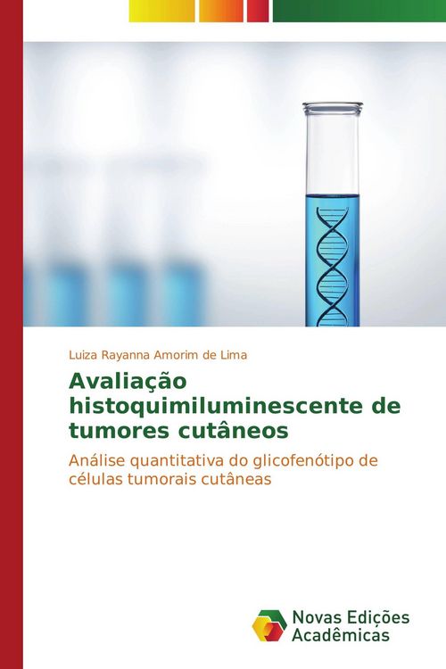 Produktbild: Avalia&ccedil;&atilde;o histoquimiluminescente de tumores cut&acirc;neos