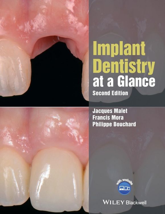 Produktbild: Implant Dentistry at a Glance