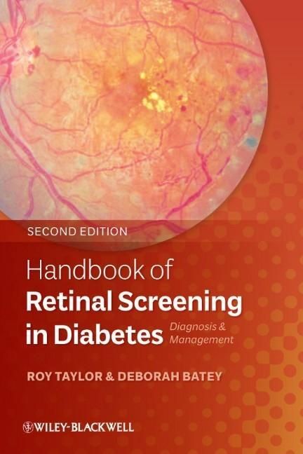 Produktbild: Handbook of Retinal Screening in Diabetes