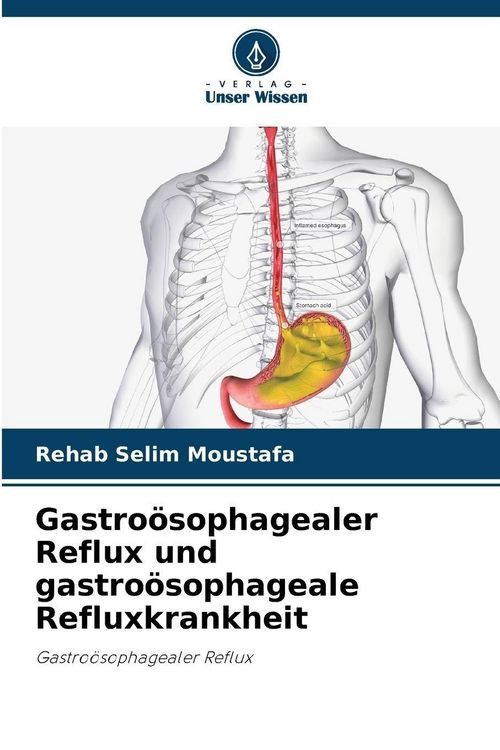 Produktbild: Gastro&ouml;sophagealer Reflux und gastro&ouml;sophageale Refluxkrankheit