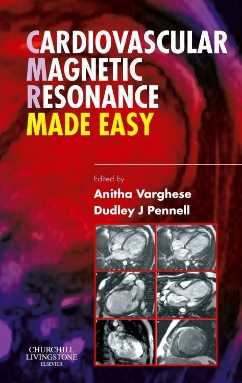 Produktbild: Cardiovascular Magnetic Resonance Made Easy