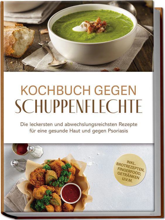 Produktbild: Kochbuch gegen Schuppenpflechte: Die leckersten und abwechslungsreichsten Rezept